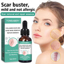 Narbenentfernung Ätherisches Öl Dehnungsstreifen Akneflecken Narbenchirurgie.