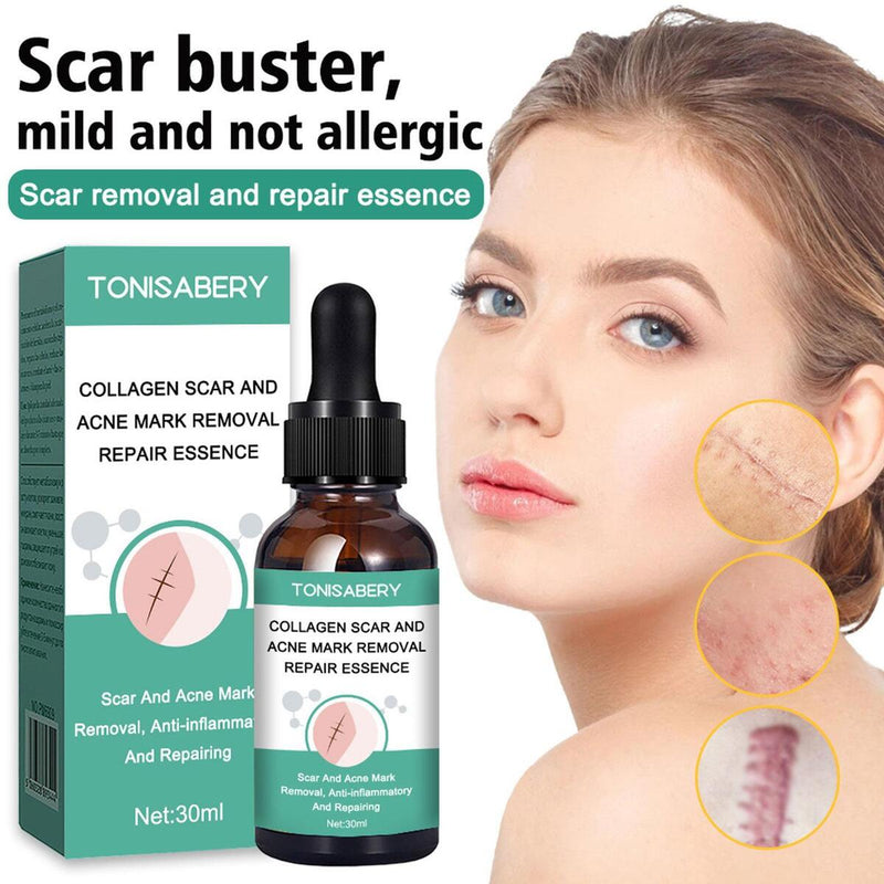 Narbenentfernung Ätherisches Öl Dehnungsstreifen Akneflecken Narbenchirurgie.