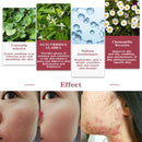 MEIYANQIONG Centella Asiatica Acne Removing Essence Skin Moisture Serum