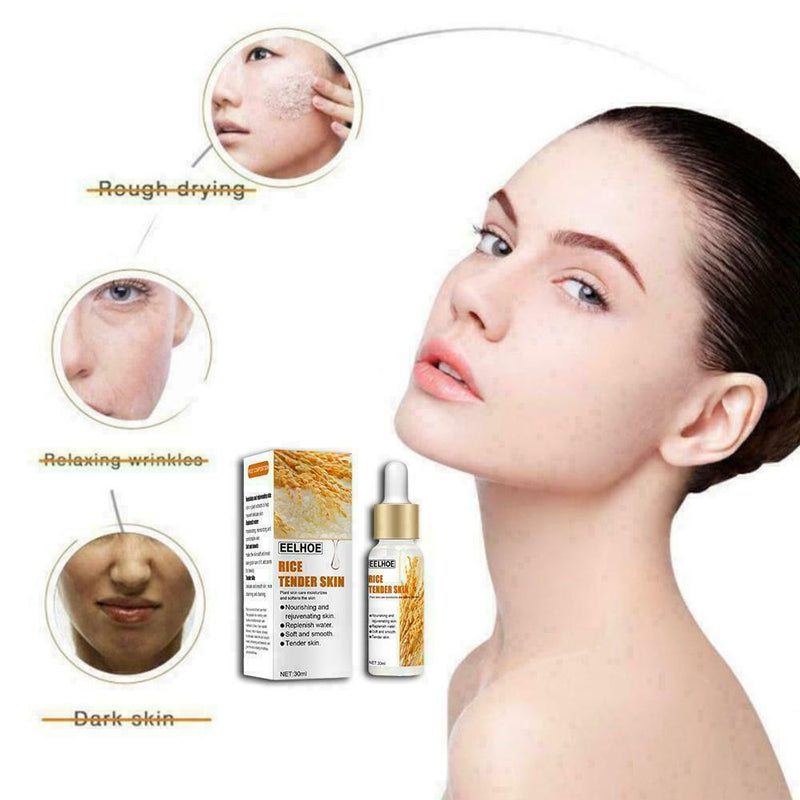 White Rice Whitening Serum Moisturizer Acne Fine Line C1N1 Treatment B4R6