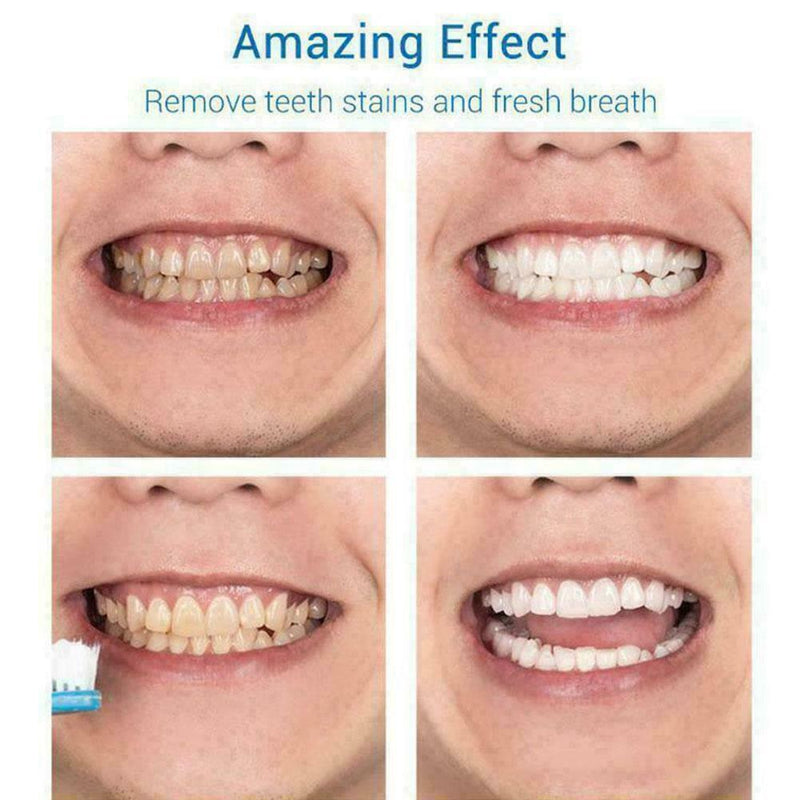 Teeth-Cleaning Whitening Mousse Toothpaste Removes Plaque W4R7 Stains O5D9
