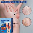 Varicose Vein Patch Leg Relief Blood Promote Patch Pain Smooth Vasculitis Q1B5
