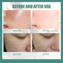 Silk Protein Soap Oil Control Face Deep Cleansing Pores Mites Acne Remover