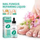 30ml Toenail Fungus Oil Nail Repair Liquid for Fingernails Anti Fungal Whitening