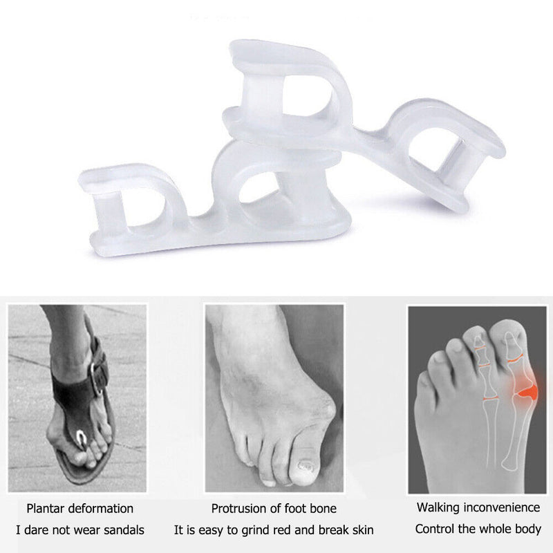 1 Pair Toe Separator Bunion Splint Hallux Valgus Overlapping Orthosis Prote