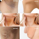 Dark Skin Bleaching Creme Whitening Lightening - Knie und Ellbogen 15g.
