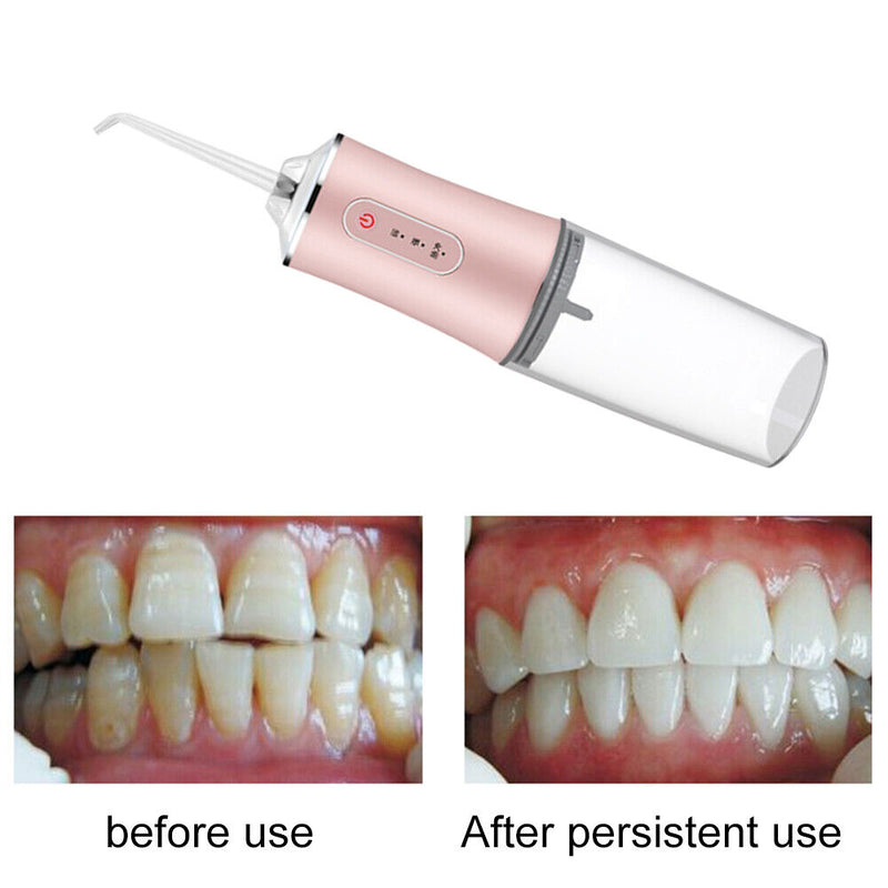 Oral Irrigator USB Rechargeable Water Flosser 300ML Teeth Cleaner (Pink) Newly