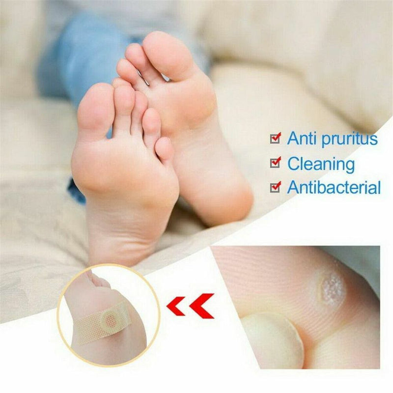 Wart Stick Wart Freeze Wart Remover Corn Removers For Feet Wart Remover Pads