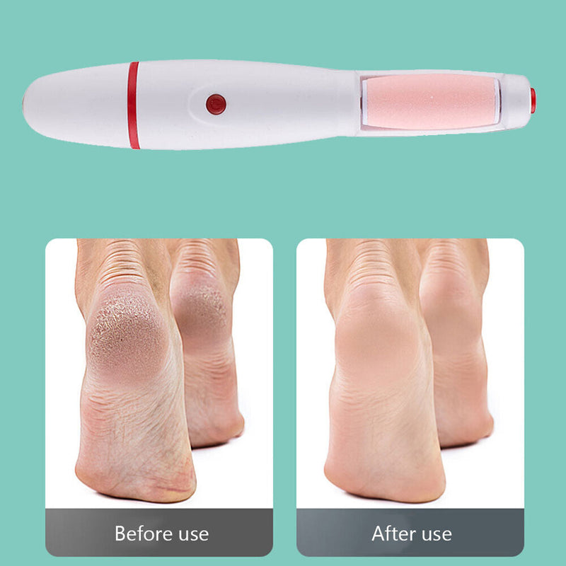 Electric USB Charging Foot Grinder Machine Feet Callus Grind Rubbing Exfoliator