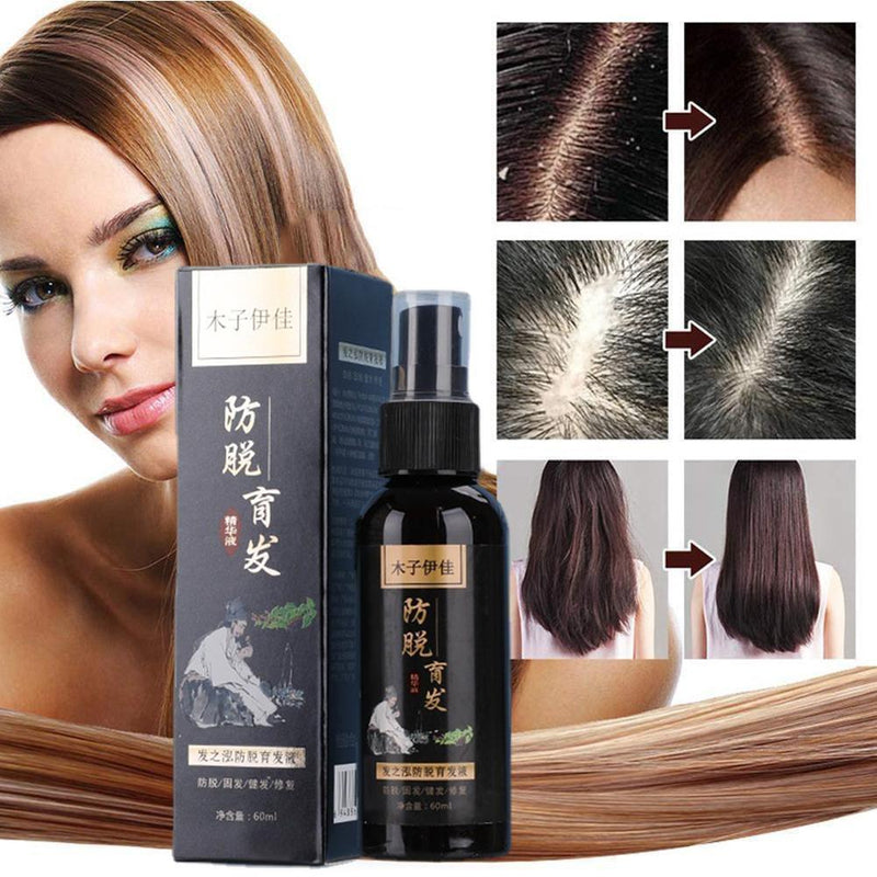 Anti-hair loss liquid He Shou Wu Ginger Extract Essence Shampoo Hair Dense_