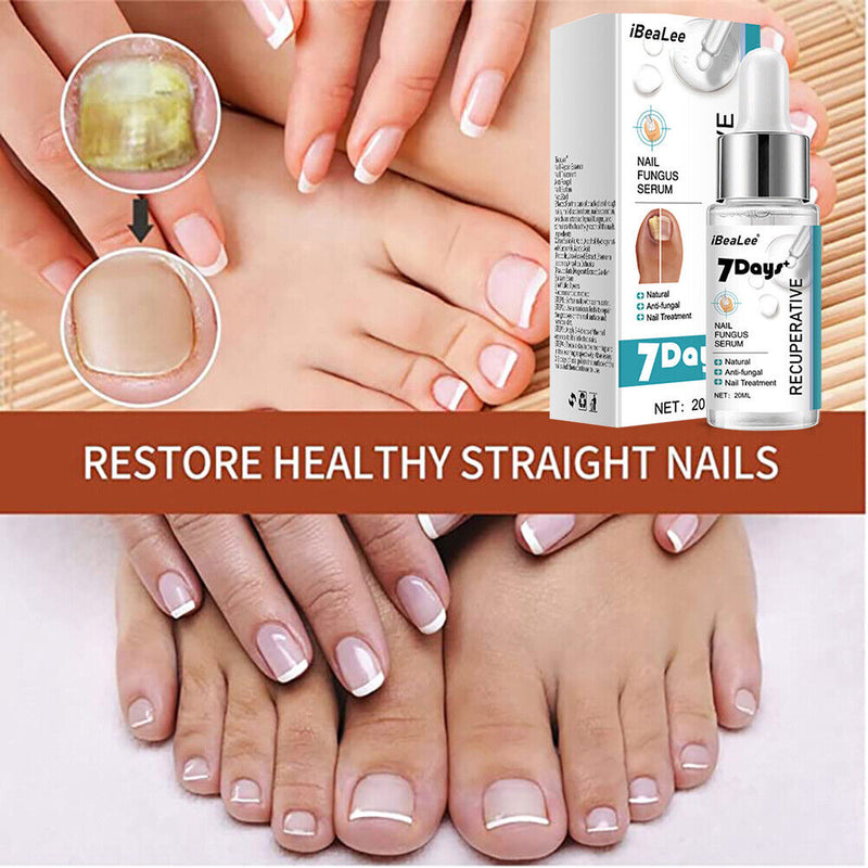 20ml Nail Repair Fluid Anti Infection Paronychia Essence Effective for Foot Care