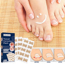 Visibly Effection Ingrown Toenail Stickers Paronychia Treatment Nail Care Tools