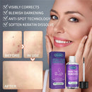 Wart Treatment Liquid Anti Verruca Remedy Warts Remover Removing Against Moles
