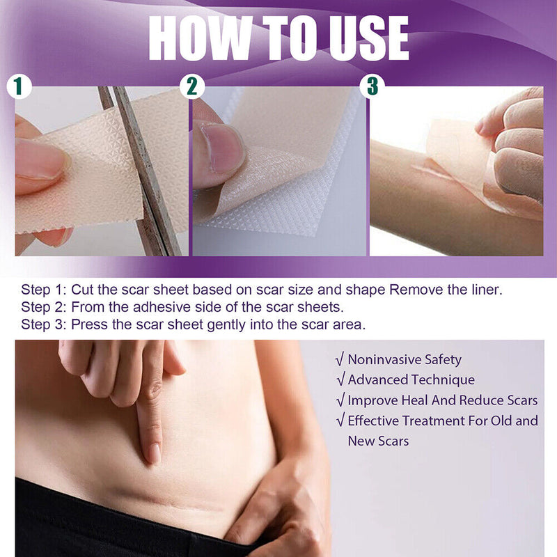 4pcs Silicone Scar Sheets Gel Strips Patch Reusable Scar Removes Remove Tra
