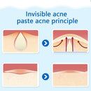 36pcs/sheet Acne Patch&Skin Tags Beauty Remover Pimple Master Patch Treatm hot.