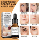 Pore Shrink Face Serum Oil Control Remove Dark Spots Whitening Essence_