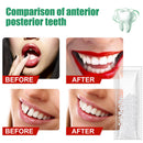 Temporary Tooth Repair Beads Missing Broken Teeth Filling Material (10g) Newly