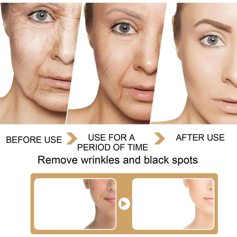 2*30ML Turmeric Face Serum Turmeric Dark Spot Corrector Serums Corrector Remove~