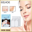 Master Acne Spot Treatment Ance Pimple Patches Skin Tag Remover Patch