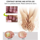Nail Care Solution Finger Toenails Repair Anti-Fungal Essence Nutrition Liquid`