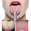 Health Tool Stainless Steel Dental Cleaning Oral Hygiene Tongue Scraper Cleaner