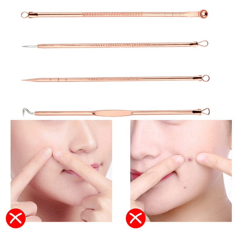 4pcs Practical Blackhead Remover Beauty Squeeze Tools Spots Acne Needle Kit