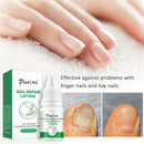 Nail Care Solution Finger Toenails Repair Anti-Fungal Essence Nutrition Liquid`