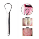 Steel Tongue Scraper Cleaner Kids Men Women Mouth Dental M9C5 Care A8L8