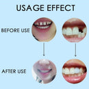10g Denture Solid Glue Dental Restoration Temporary Tooth Repair Kit (10g) Newly
