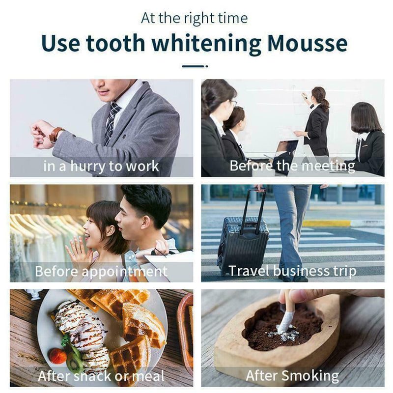 Toothpaste Mousse Cleaning Teeth Remove Tooth Stains BEST Teeth Foam O8R3