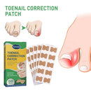 Ingrown Toenail Correction Stickers Nail Corrector Patches Nail Care Tool!