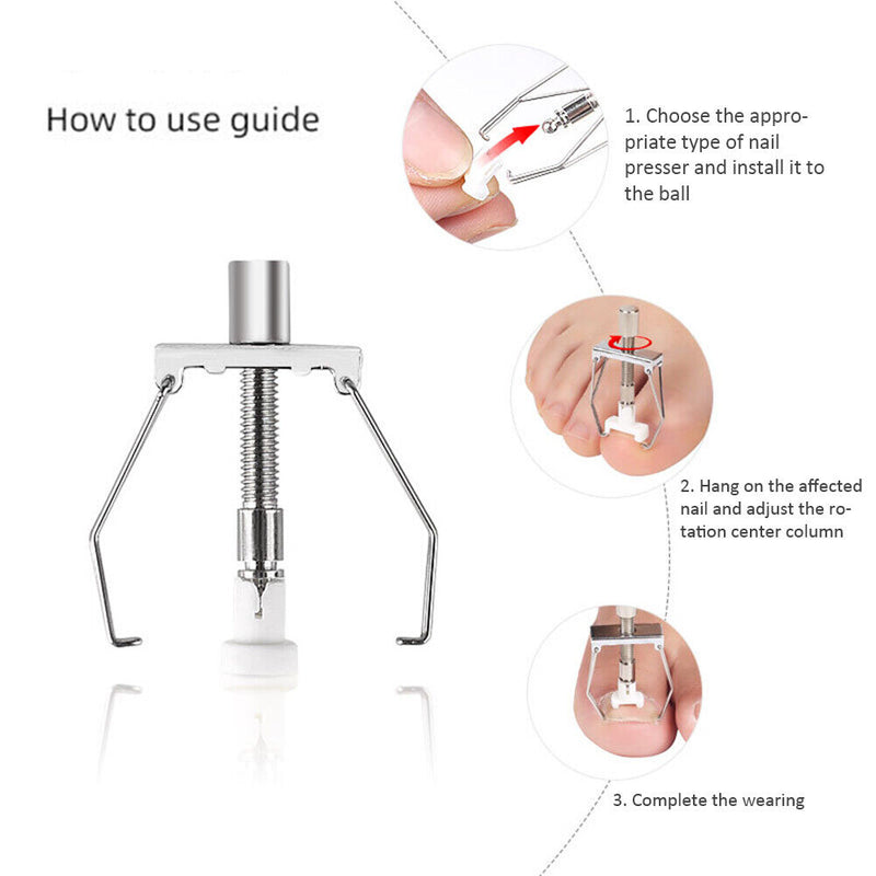Fixer Ingrown Nail Correction Tool Pedicure Foot Embed Nails Care Corrector Set