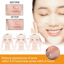Tag Remover Patch Ance Pimple Patches Acne Spot Treatment Hydrocolloid Master