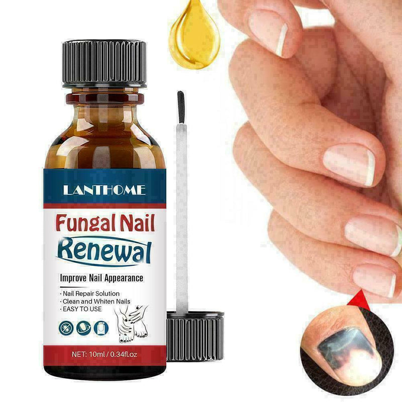 Nail Repair Anti Fungal Nail Infection Onychomycosis ml 10 D7D8 M6G7 M6J4 J8F5