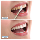 Health Care Stain Remover Oral Hygiene Dentifrice Teeth Whitening Serum Gel