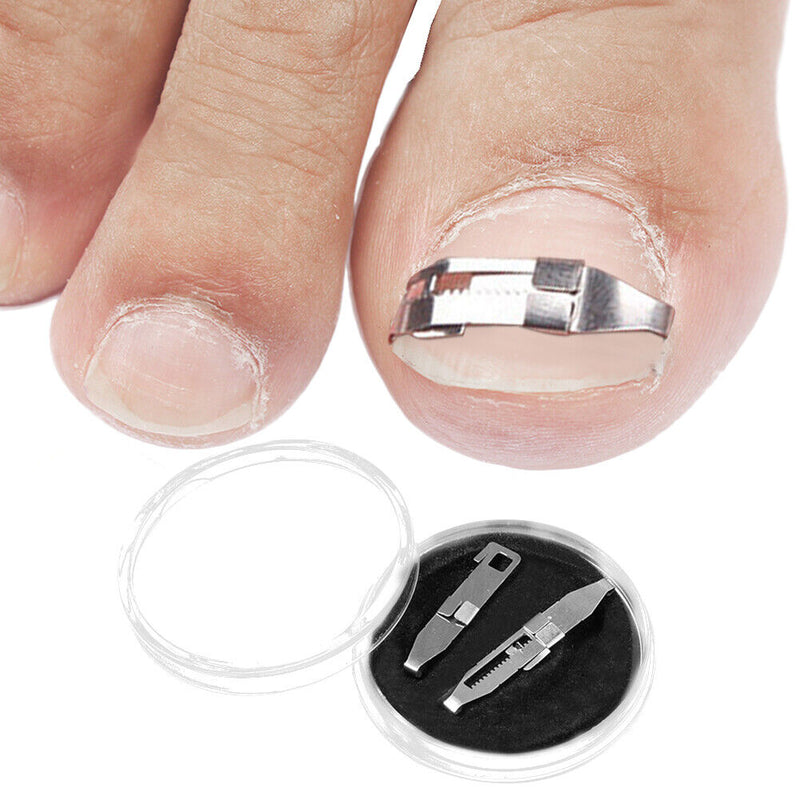 1 Pair Ingrown Toe Nail Fixer Embed Toenail Correction Lifter Pedicure Recover