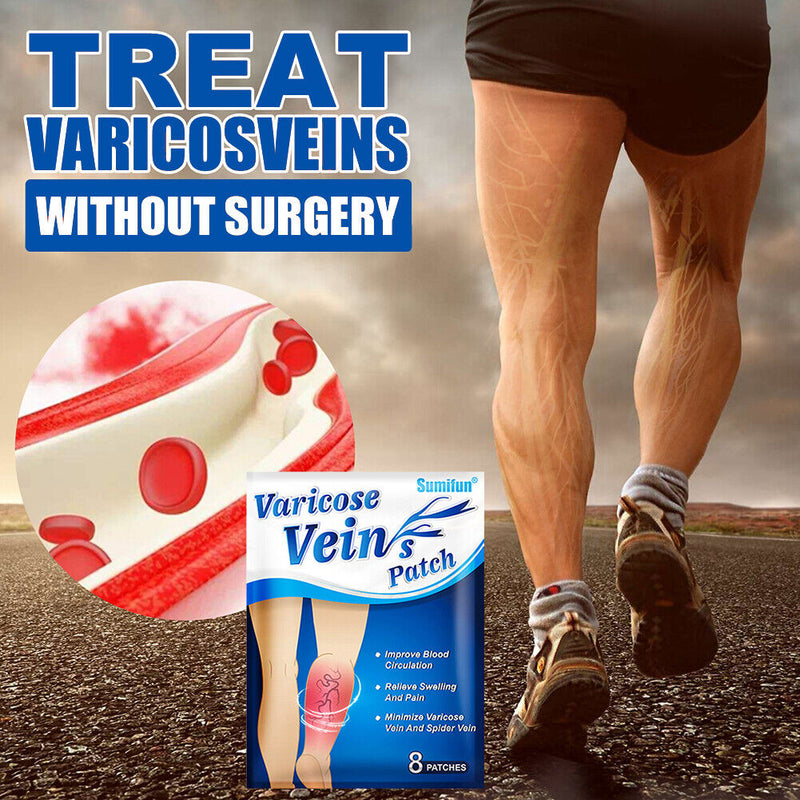 Varicose Vein Treatment Patches Pain Relief Vasculitis Phlebitis Herbal Pla