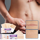 #A 4pcs Silicone Scar Sheets Gel Strips Patch Reusable Self Adhesive Scar Remove