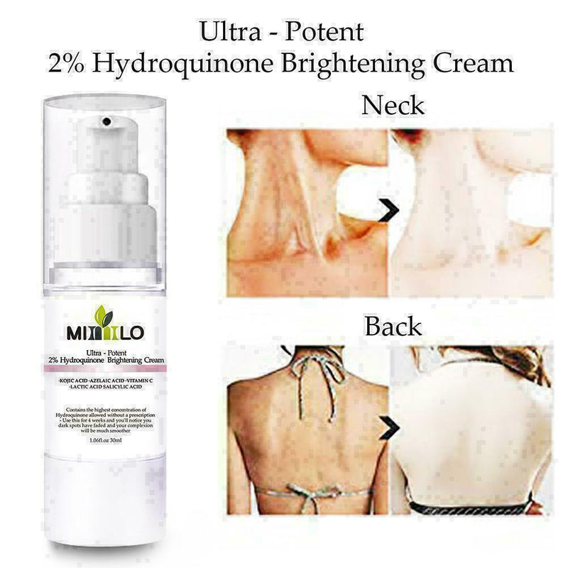 Brightens Skin 30ml Skin Fades Spots Freckles Yellow L8E3 Dark Q1L4 F5P9 W4S5