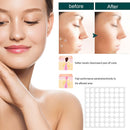 120pcs Skin Tag Remover Patch Wart Treatment Stickers Quick Absorb Plaster