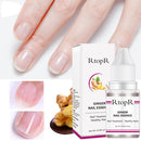 Ginger Nail Treatment Serum Hand and Foot Absorb Nutrients for Growing Healthily