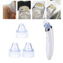 Facial Acne Blackhead Remover Vacuum Suction Pore Clean Machine (White A)