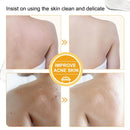 Papaya Kojic Acid Soap Deep Cleansing Softening Cuticle Lightening Melanin{