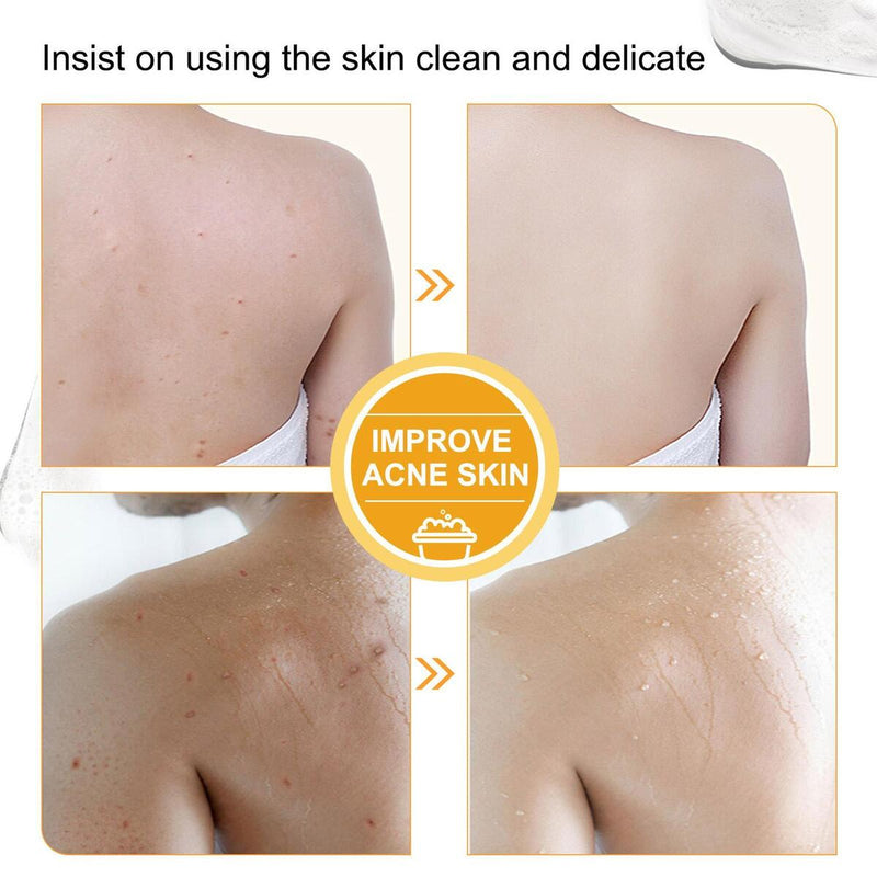 Papaya Kojic Acid Soap Deep Cleansing Softening Cuticle Lightening Melanin{