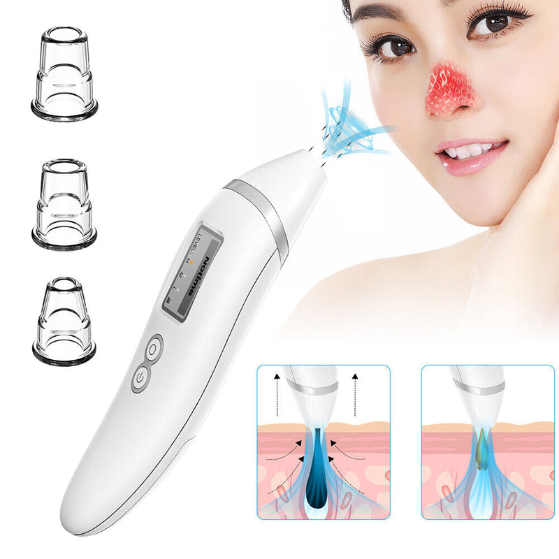 Blackhead remover, pore cleanser pore vacuum cleaner blackhead remover blackhead vacuum cleaner U