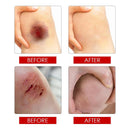 Transparent Liquid Skin Bandage Waterproof Glue Aid Band Invisible Bandage`