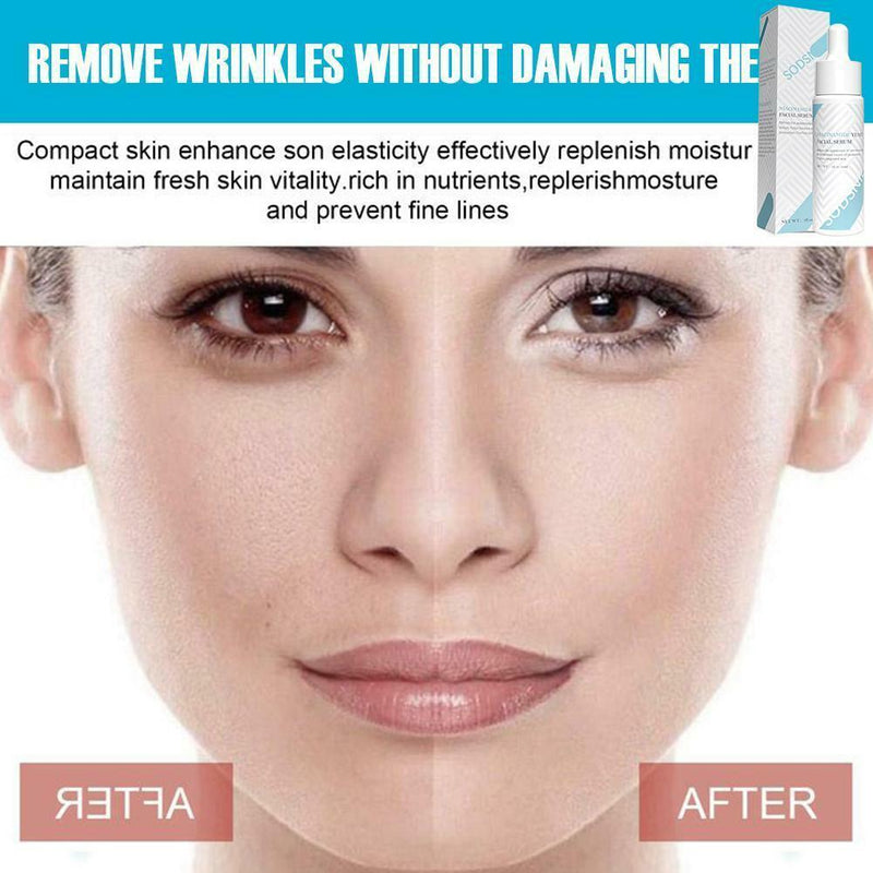 Niacinamide Yeast Facial Serum Moisturizing Anti-drying Nourishing Lifting Firmi