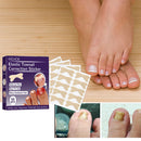 50pcs Stickers Ingrown Toenail Correction Stickers Nail Corrector Patches