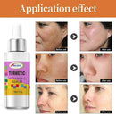 Turmeric Oil Skin Acne Clear Skin Dark Spot Corrector Whitening Serum Face K2J5