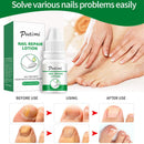 Nail Care Solution Finger Toenails Repair Anti-Fungal Essence Nutrition Liquid`